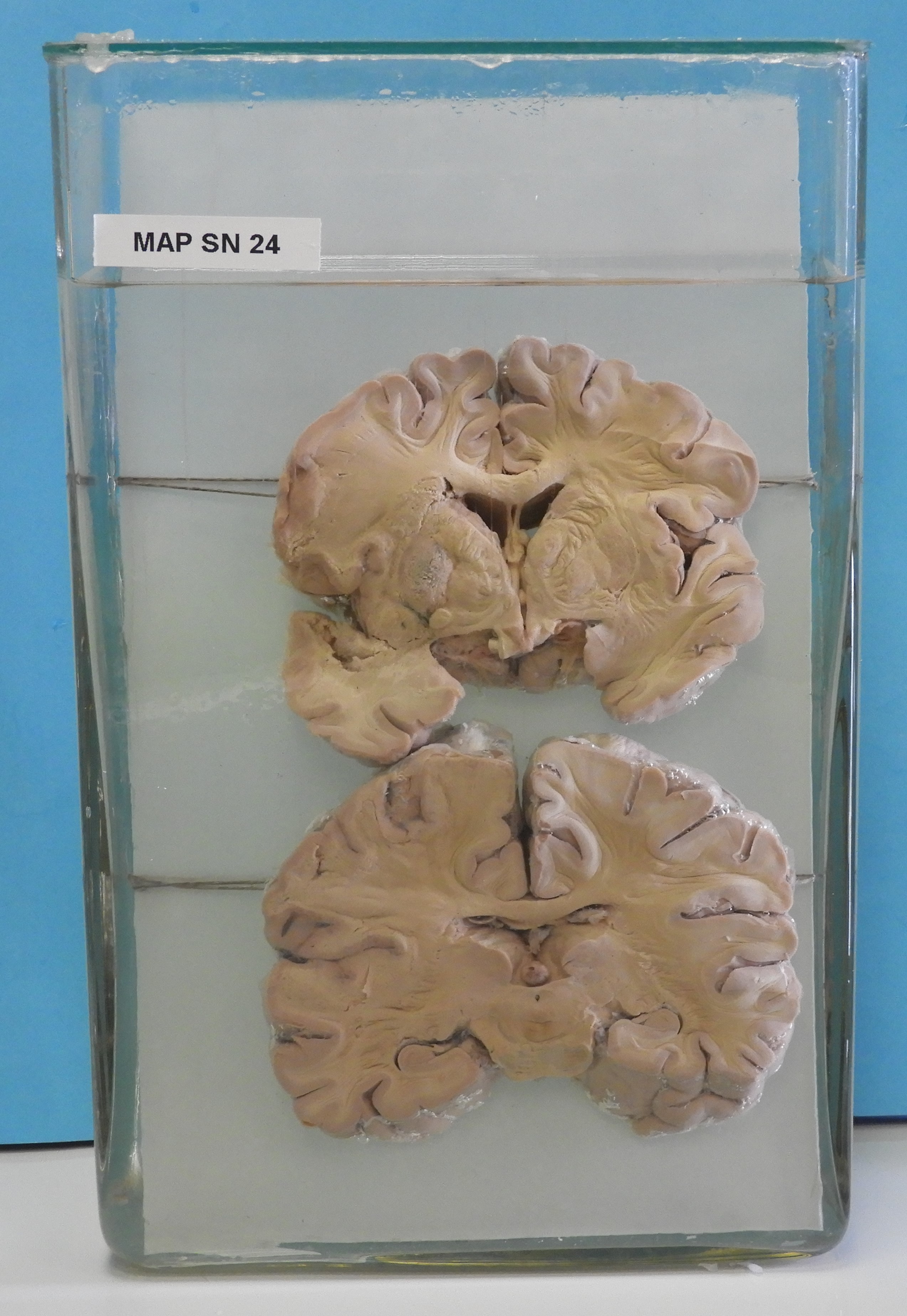 preparato anatomico, sistema nervoso (morfologia naturale) (SECOLI/ XX)