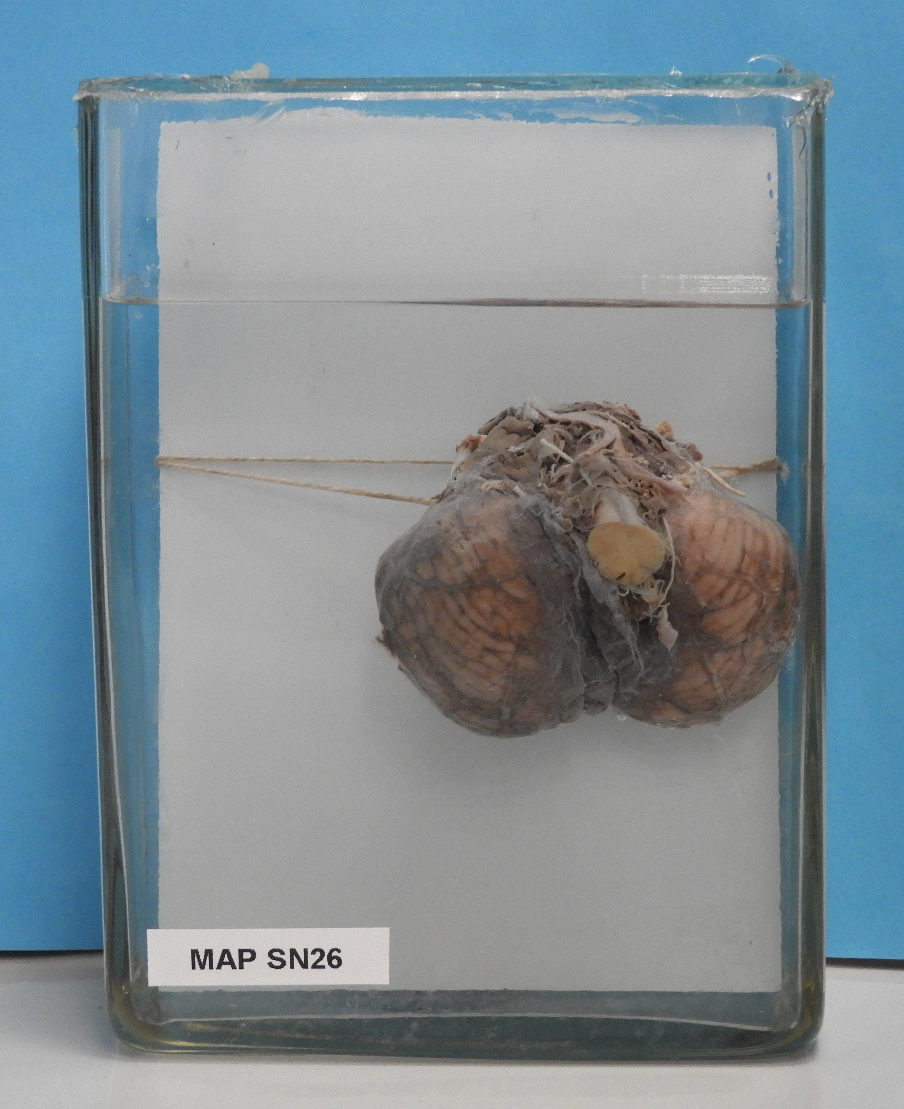 preparato anatomico, sistema nervoso (morfologia naturale) (SECOLI/ XX)