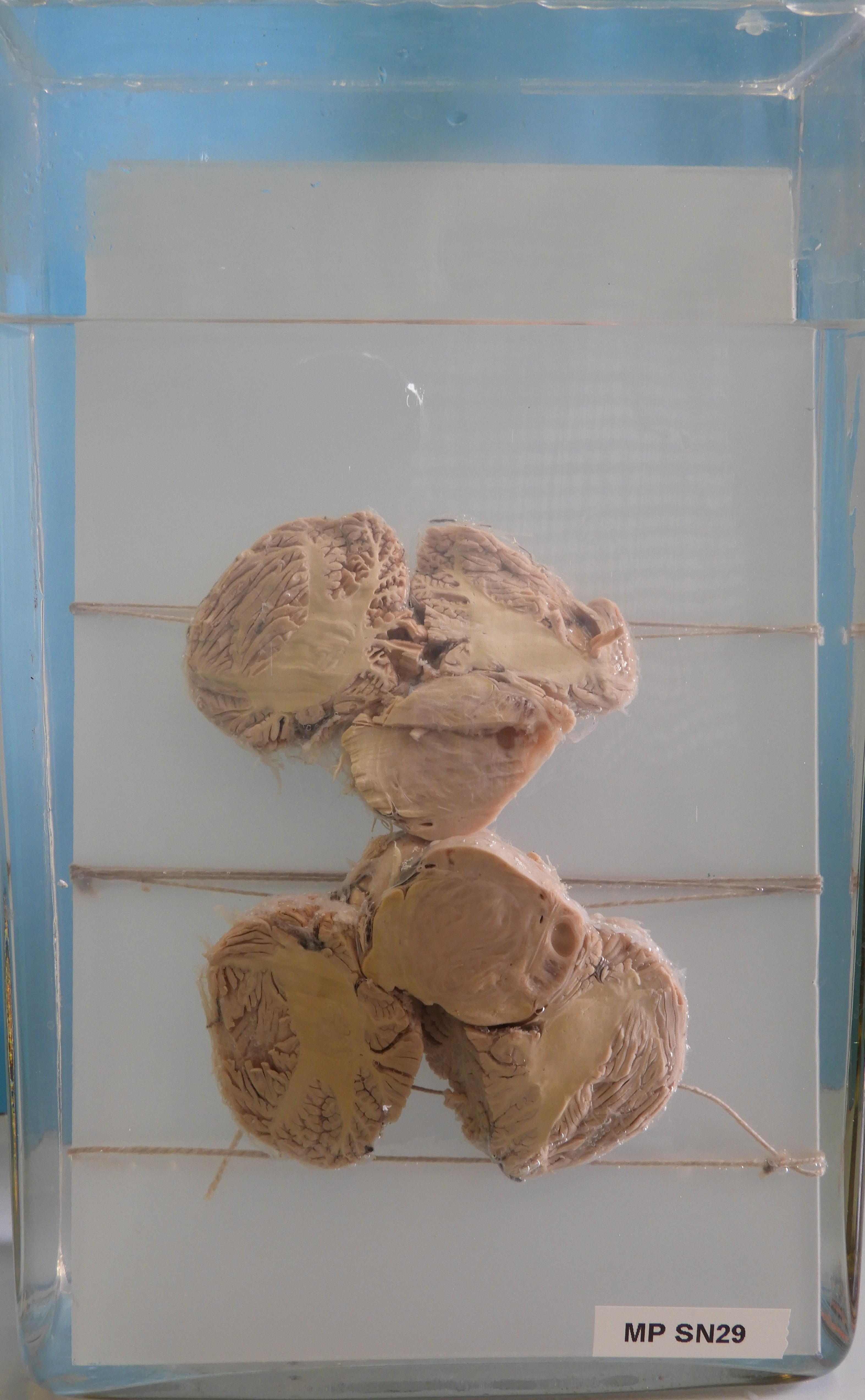 preparato anatomico, sistema nervoso (morfologia naturale) (SECOLI/ XX)