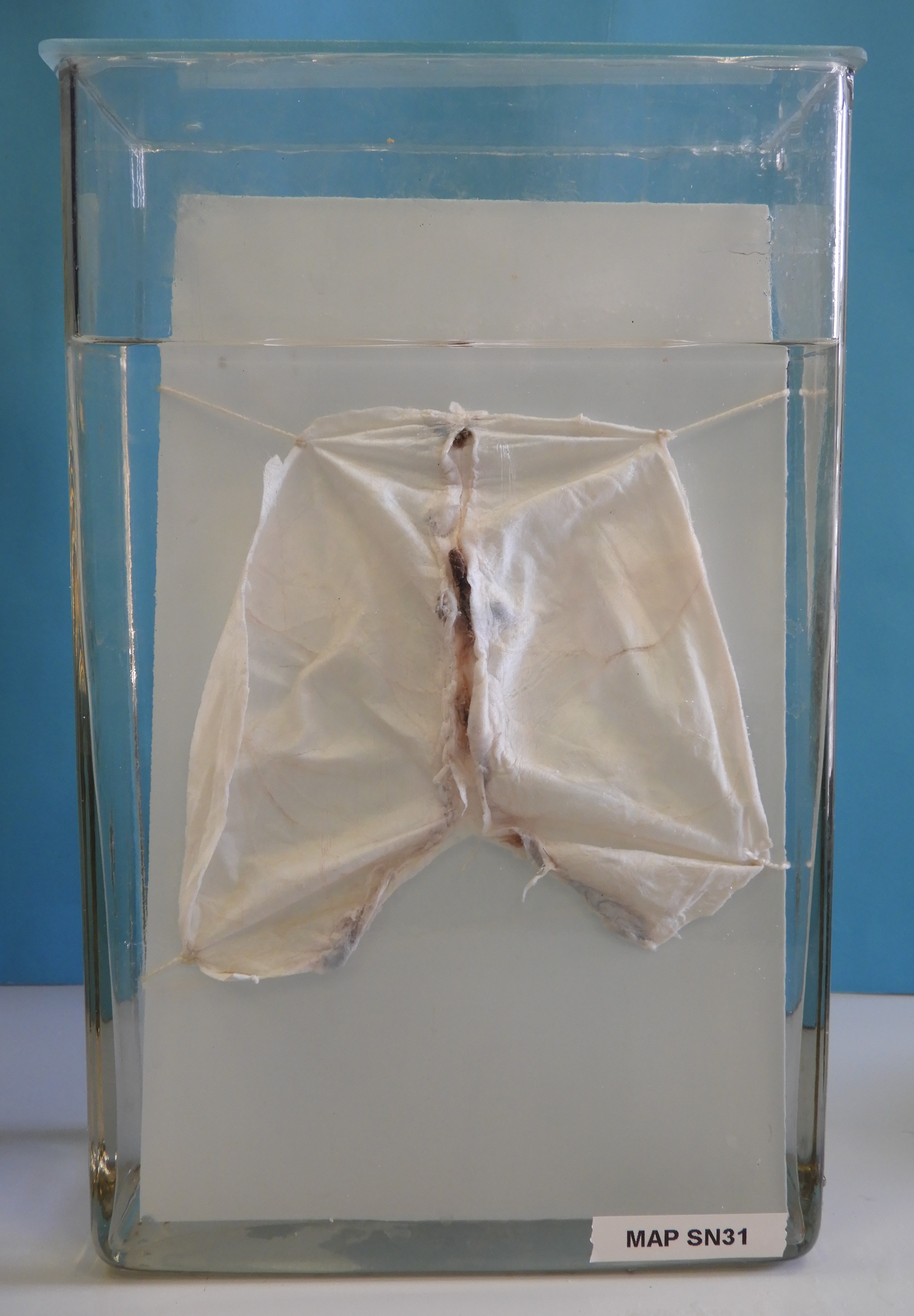 preparato anatomico, sistema nervoso (morfologia naturale) (SECOLI/ XX)