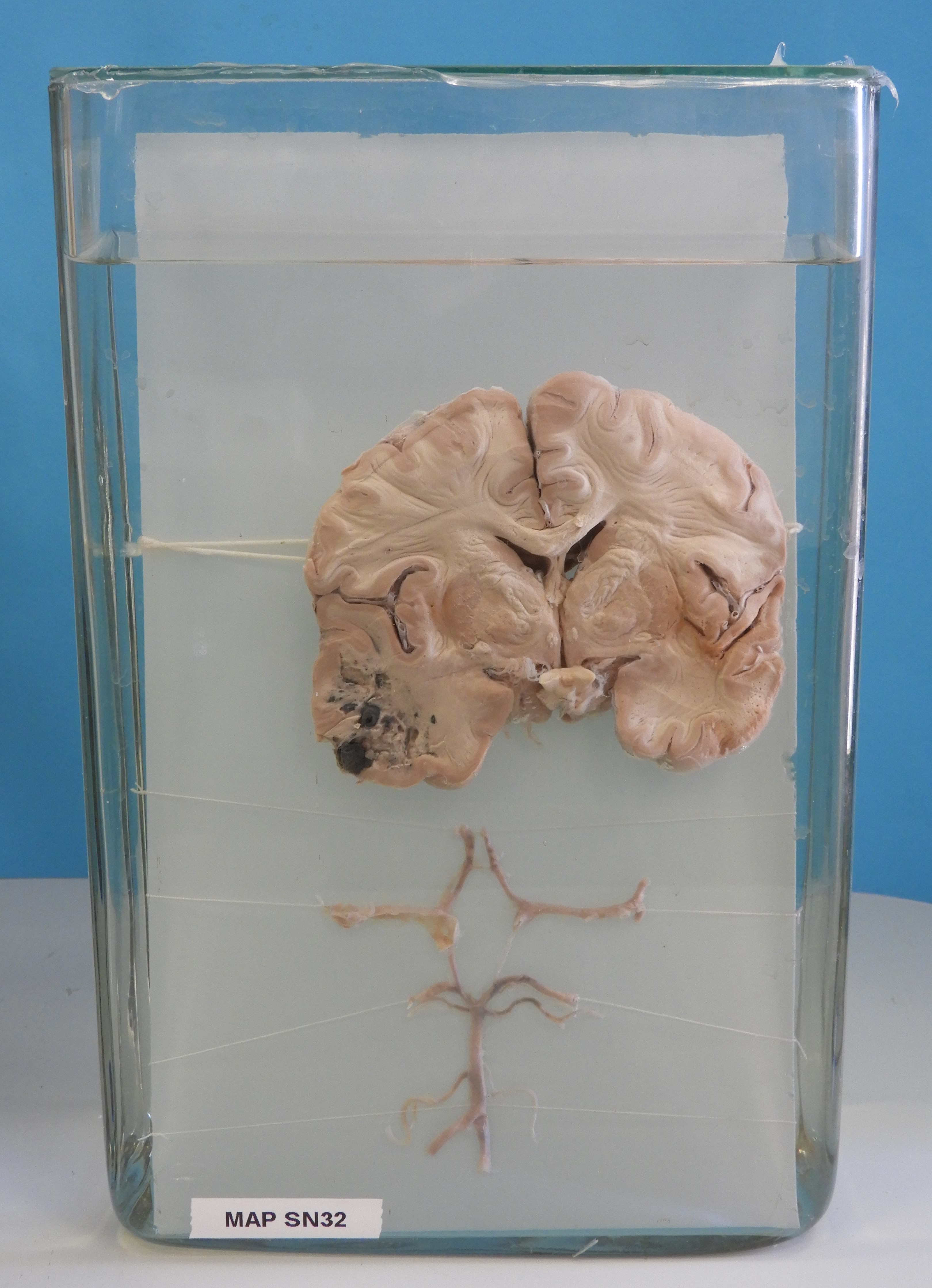 preparato anatomico, sistema nervoso (morfologia naturale) (SECOLI/ XX)