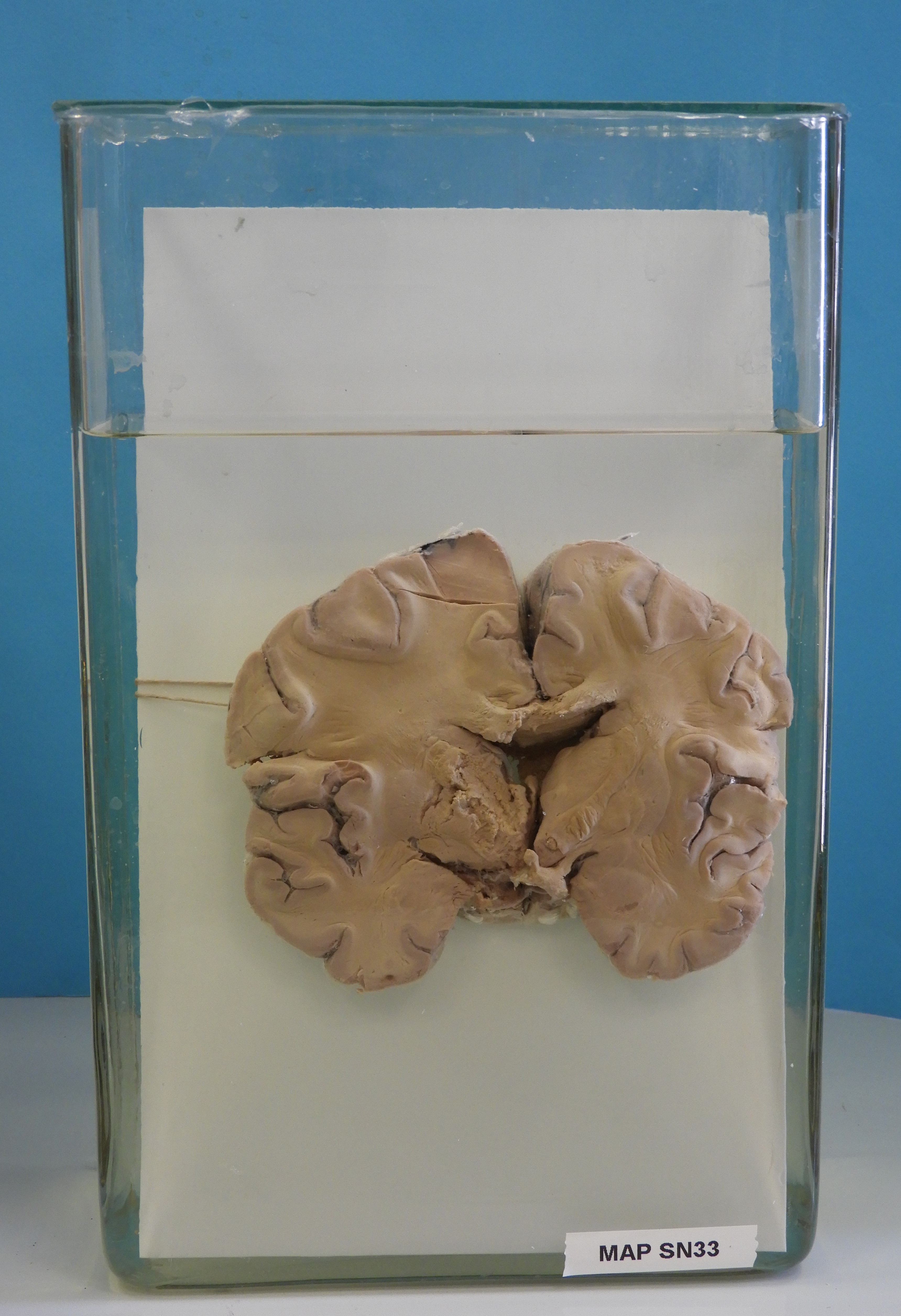 preparato anatomico, sistema nervoso (morfologia naturale) (SECOLI/ XX)