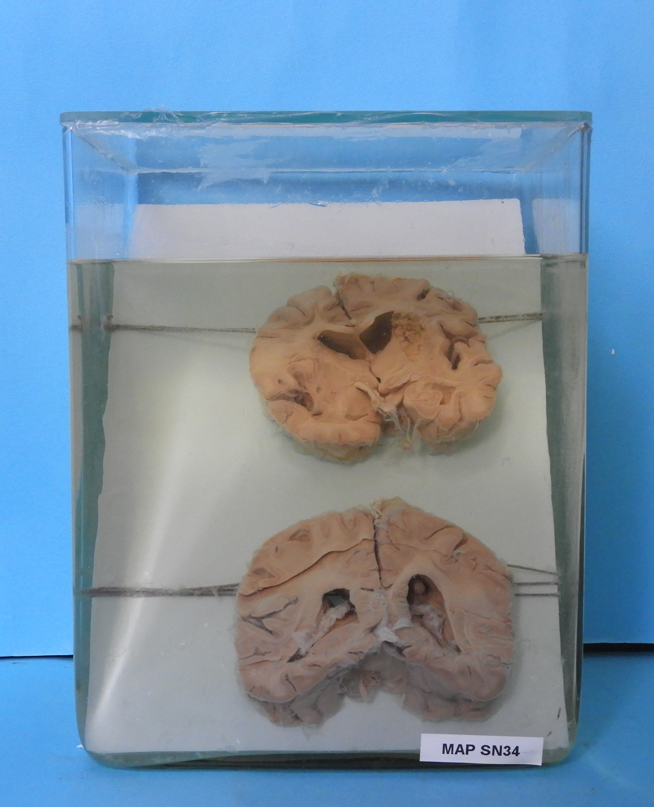 preparato anatomico, sistema nervoso (morfologia naturale) (SECOLI/ XX)