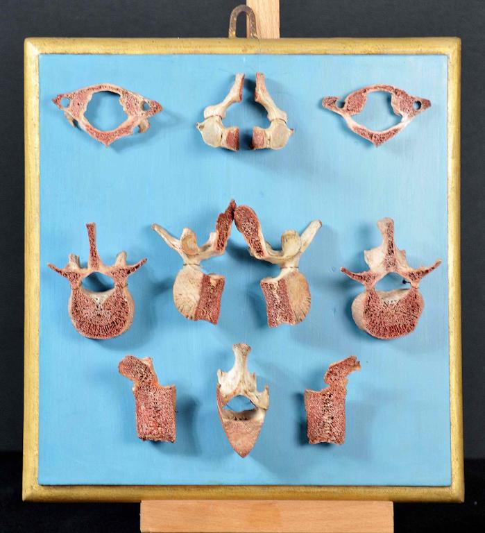 preparato anatomico, vertebre sezionate di Lelli Ercole (e aiuti) (sec. XVIII)