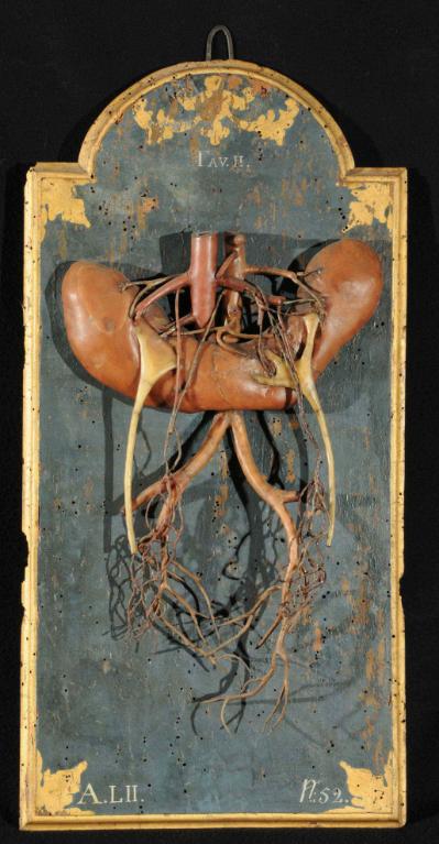 preparato anatomico, rene a ferro di cavallo di Lelli Ercole (sec. XVIII)