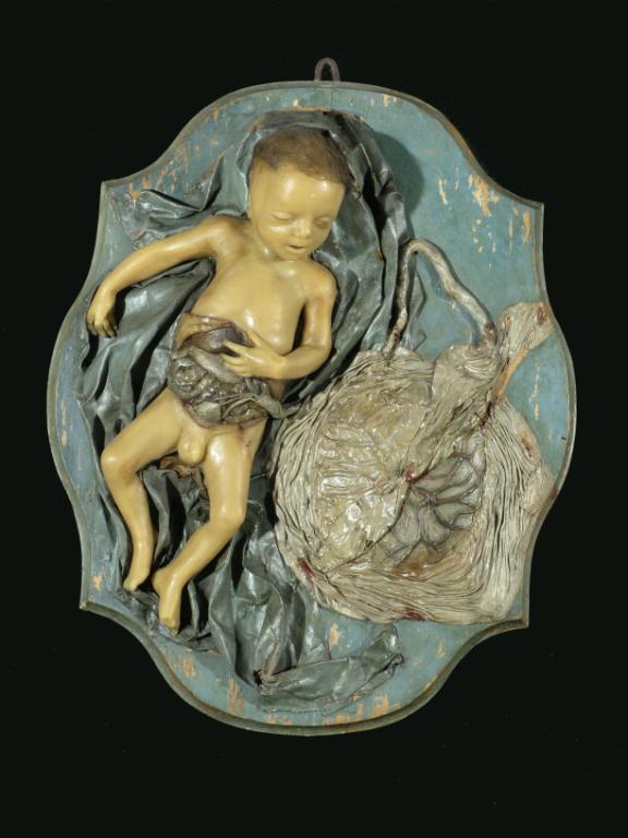 preparato anatomico, feto con placenta e cordone ombelicale di Morandi Anna (sec. XVIII)