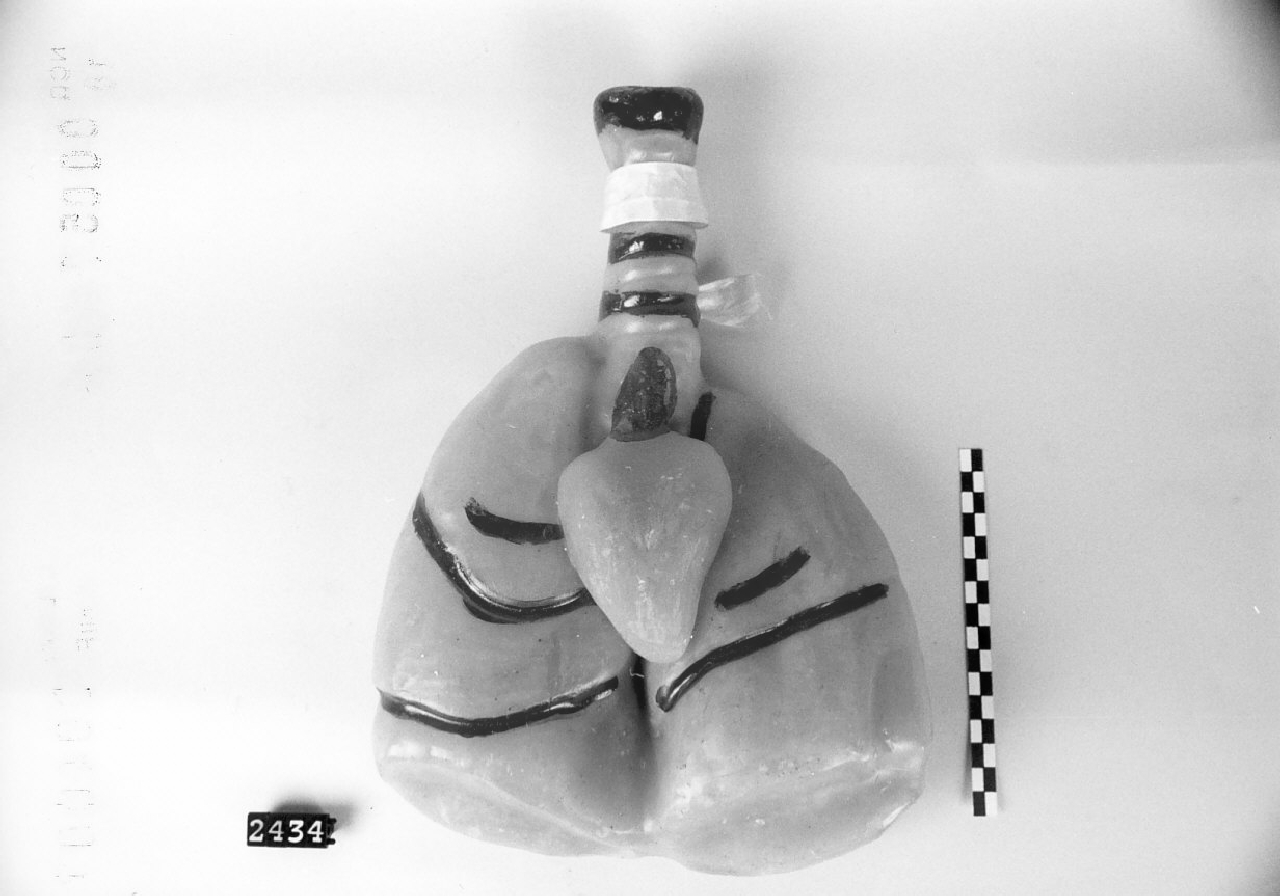 Polmoni e cuore (ex voto) - bottega Surace (1950-1980)