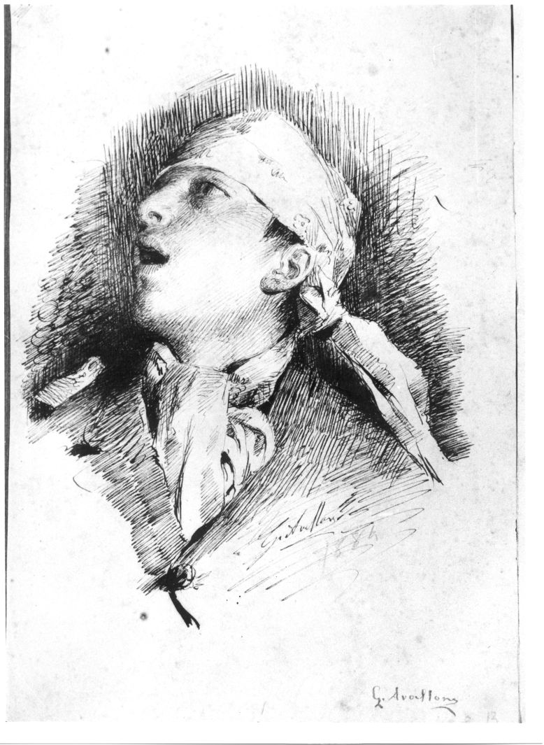 testa di ragazzo ferito (disegno) di Avallone Giuseppe (sec. XIX)