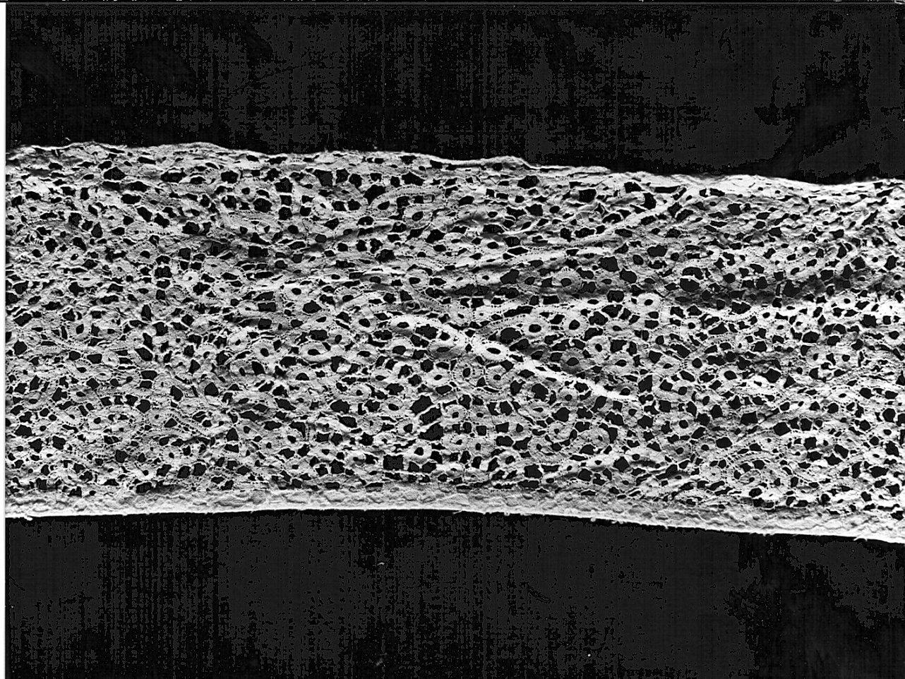 merletto, opera isolata - manifattura Italia settentrionale (seconda metà sec. XVII)