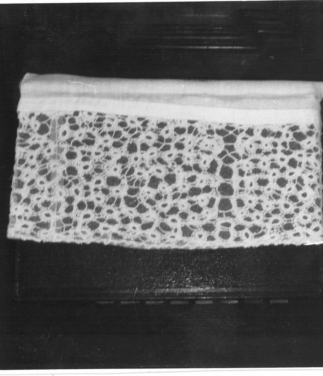 merletto, serie - manifattura lombarda (sec. XVII)