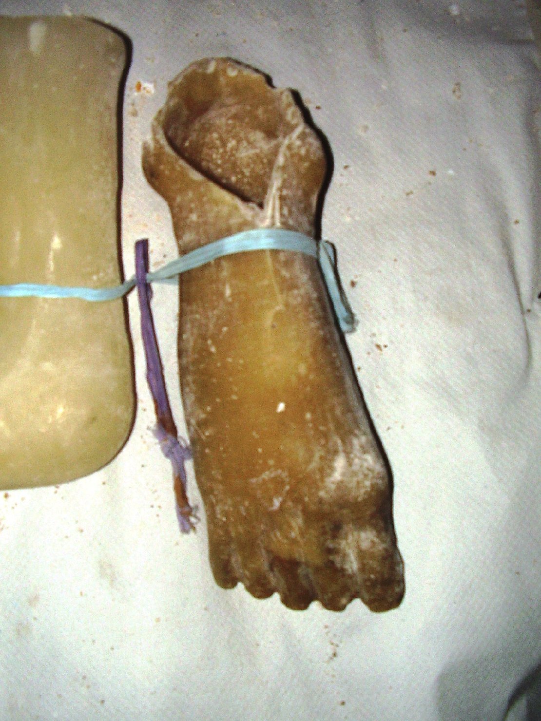 Piede (ex voto anatomico)