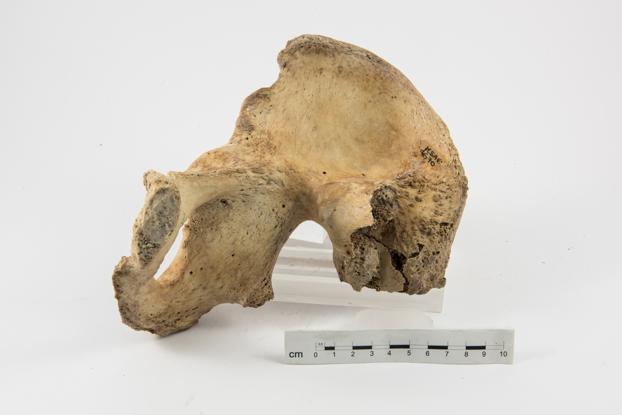 singolo reperto antropologico, reperto osseo (inumato) (Età tardo romano-medievale)
