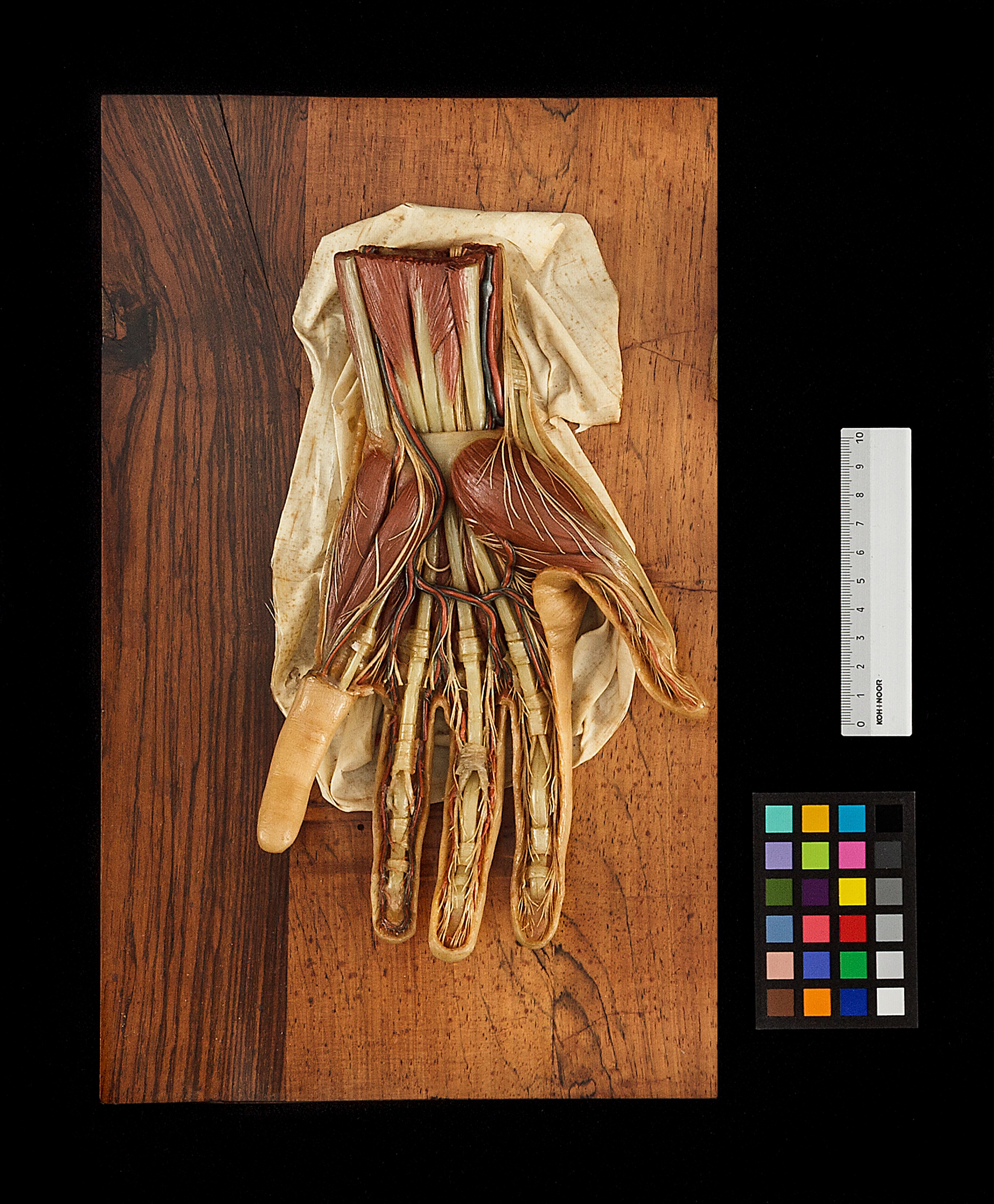cera anatomica, Mano sinistra senza tegumento di Susini Clemente (inizio sec. XIX)