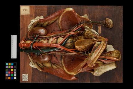 cera anatomica, Apparato urogenitale maschile di Susini Clemente (inizio sec. XIX)