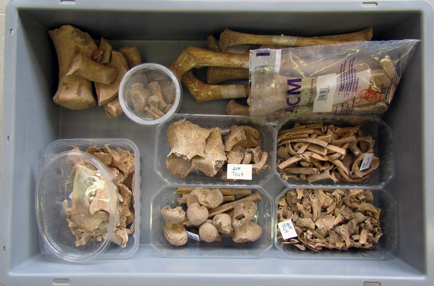 reperti antropologici pertinenti a un unico individuo, reperto osteo-dentario (morfologia naturale, inumato) (PERIODIZZAZIONI/ STORIA/ Età antica/ Età romana/ Età romana imperiale)