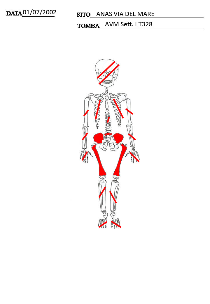 reperti antropologici pertinenti a un unico individuo, reperto osteo-dentario (morfologia naturale, inumato) (PERIODIZZAZIONI/ STORIA/ Età antica/ Età romana/ Età romana imperiale)
