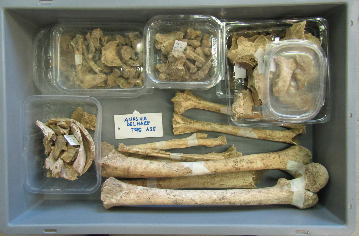 reperti antropologici pertinenti a un unico individuo, reperto osteo-dentario (morfologia naturale, inumato) (PERIODIZZAZIONI/ STORIA/ Età antica/ Età romana/ Età romana imperiale)