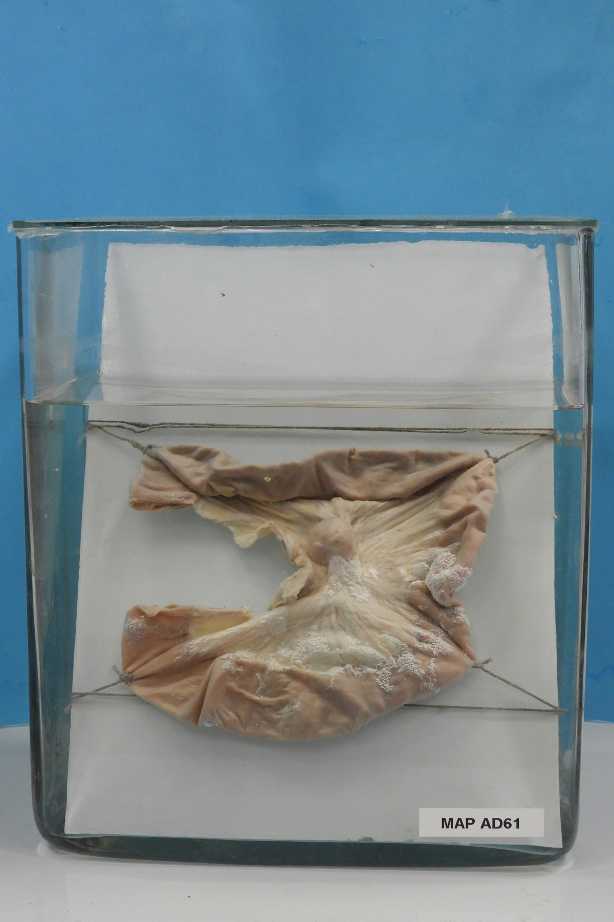 preparato anatomico, apparato digerente (morfologia naturale) (SECOLI/ XX)