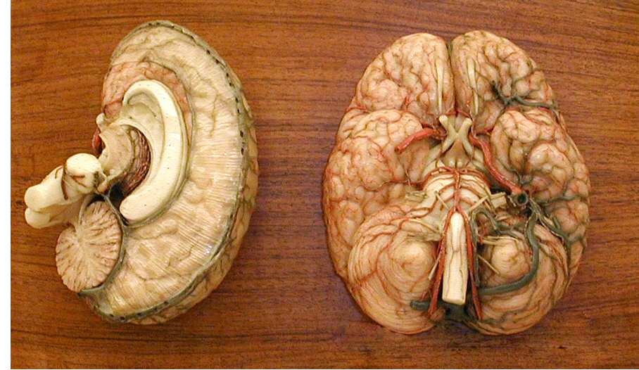modello, anatomico di Susini, Clemente (XIX sec)