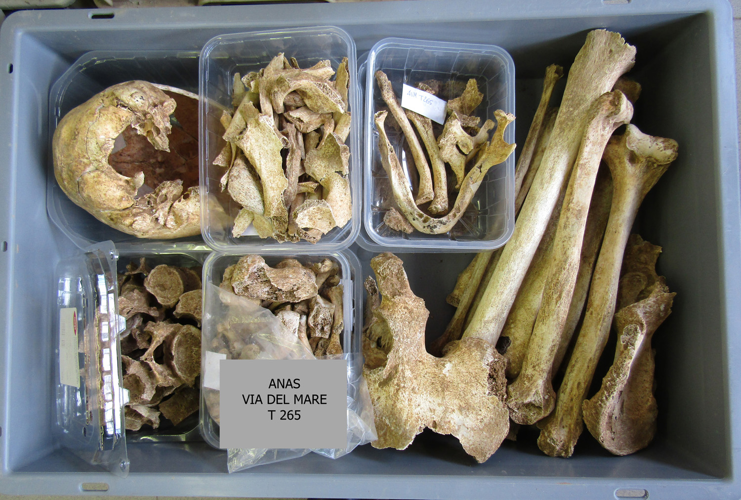 reperti antropologici pertinenti a un unico individuo, reperto osteo-dentario, reperto osseo (morfologia naturale, inumato) (PERIODIZZAZIONI/ STORIA/ Età antica/ Età romana/ Età romana imperiale)