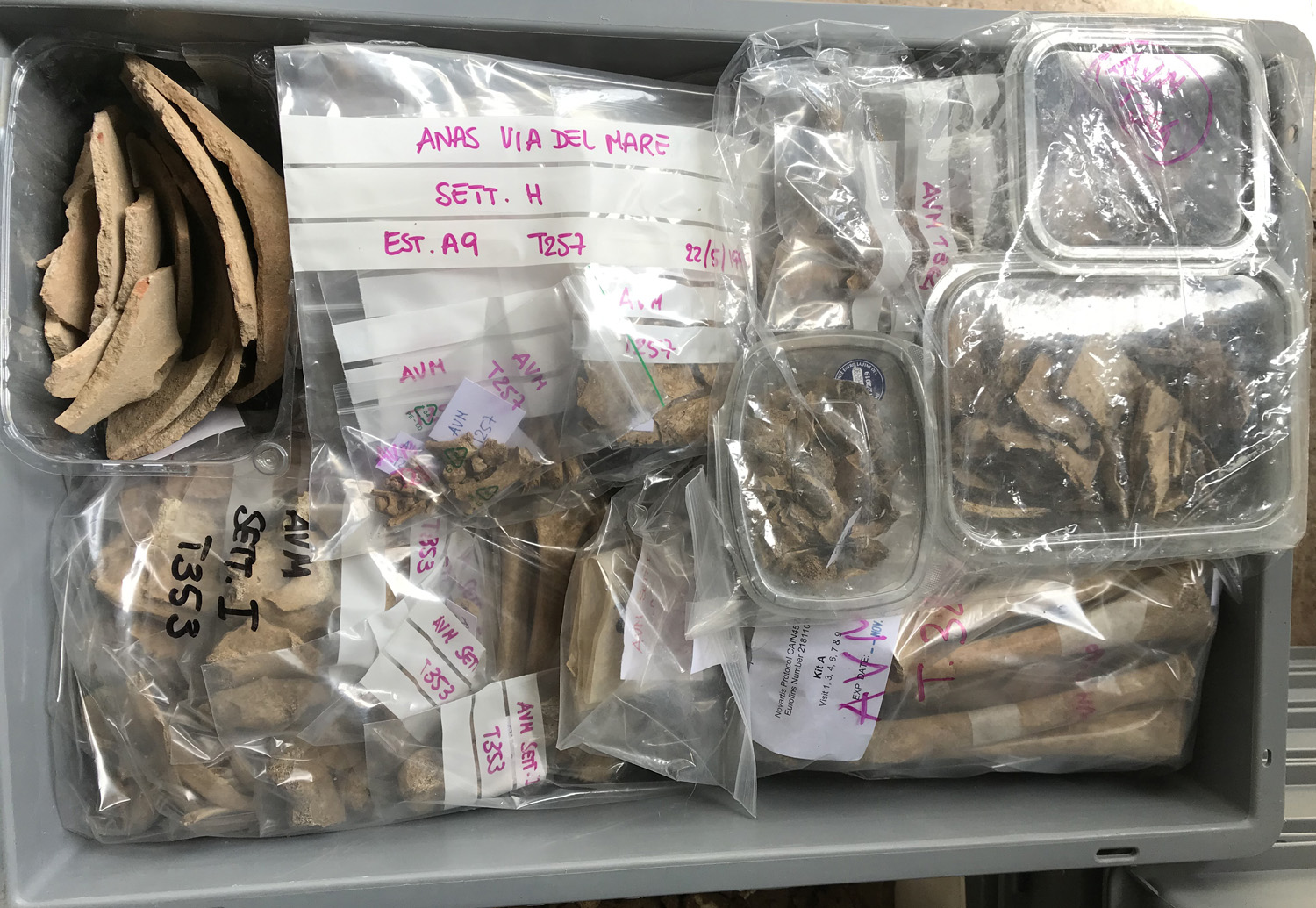 reperti antropologici pertinenti a un unico individuo, reperto osteo-dentario (morfologia naturale, inumato) (PERIODIZZAZIONI/ STORIA/ Età antica/ Età romana/ Età romana imperiale)