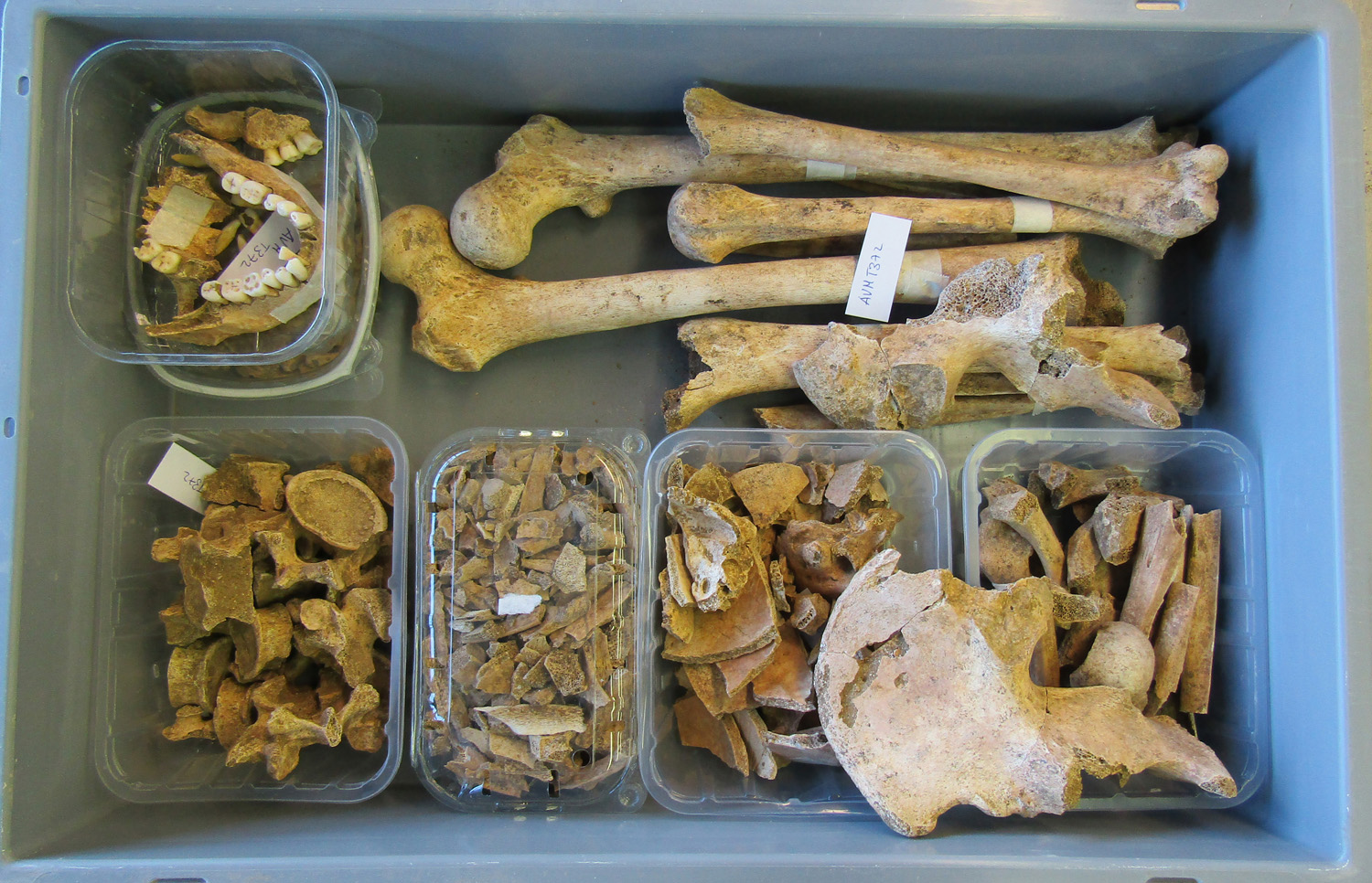 reperti antropologici pertinenti a un unico individuo, reperto osteo-dentario (morfologia naturale, inumato) (PERIODIZZAZIONI/ STORIA/ Età antica/ Età romana/ Età romana imperiale)