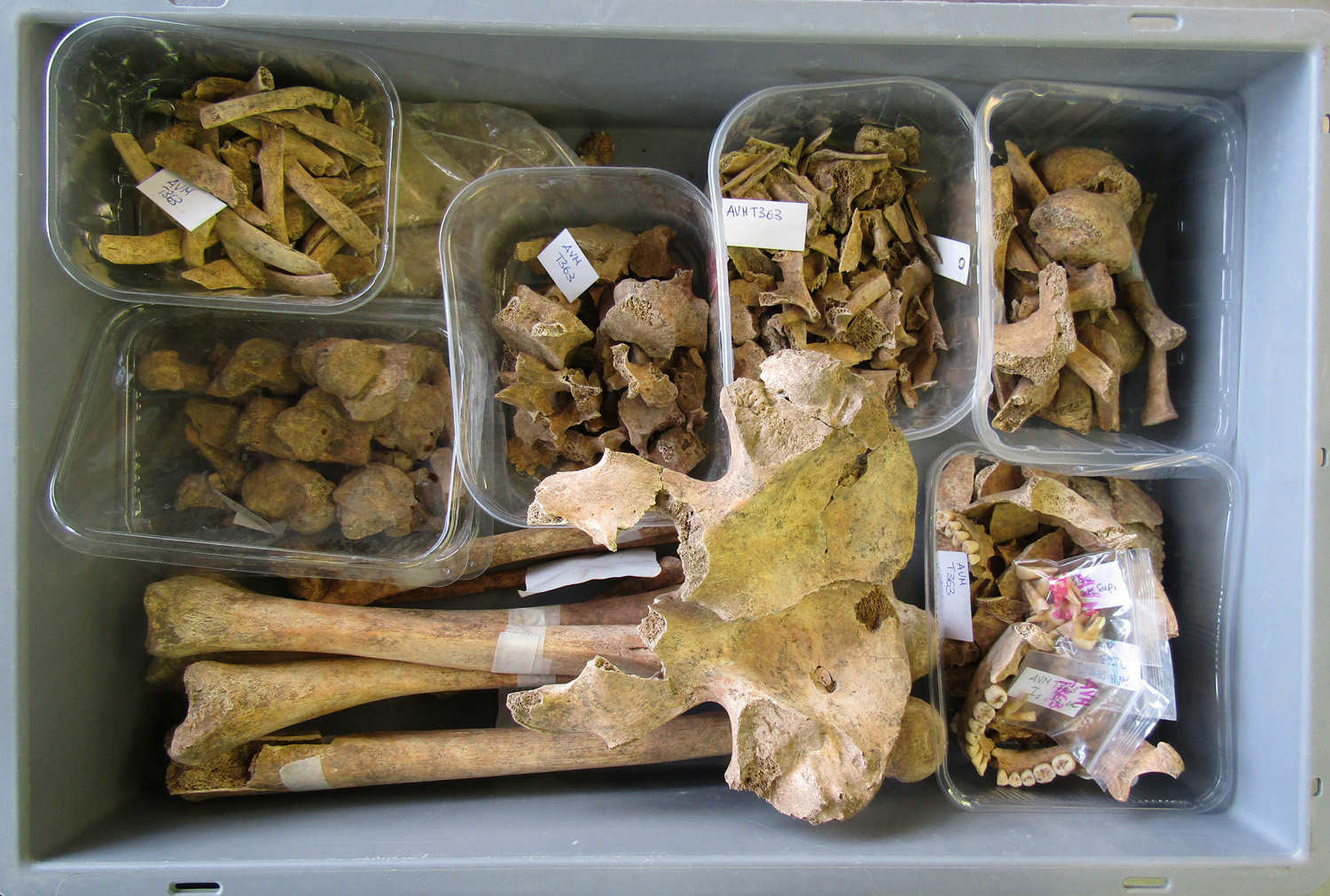 reperti antropologici pertinenti a un unico individuo, reperto osteo-dentario (morfologia naturale, inumato) (PERIODIZZAZIONI/ STORIA/ Età antica/ Età romana/ Età romana imperiale)