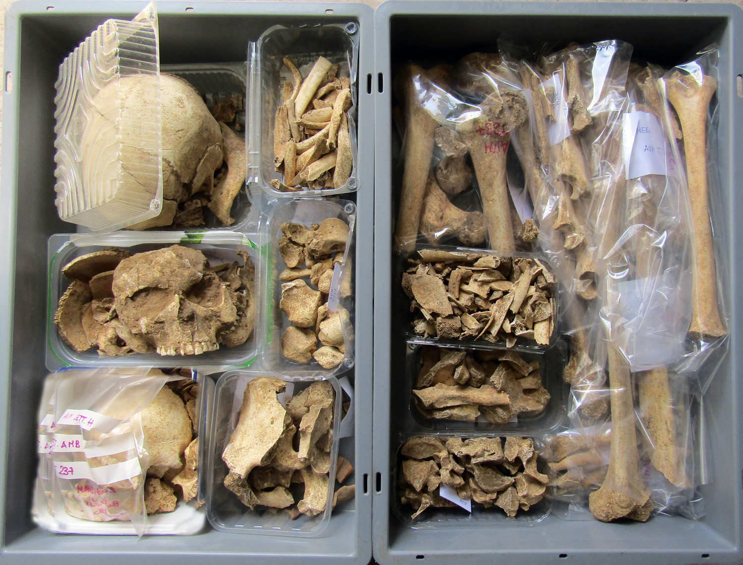 reperti antropologici pertinenti a più individui, reperto osteo-dentario (morfologia naturale, inumato) (PERIODIZZAZIONI/ STORIA/ Età antica/ Età romana/ Età romana imperiale)