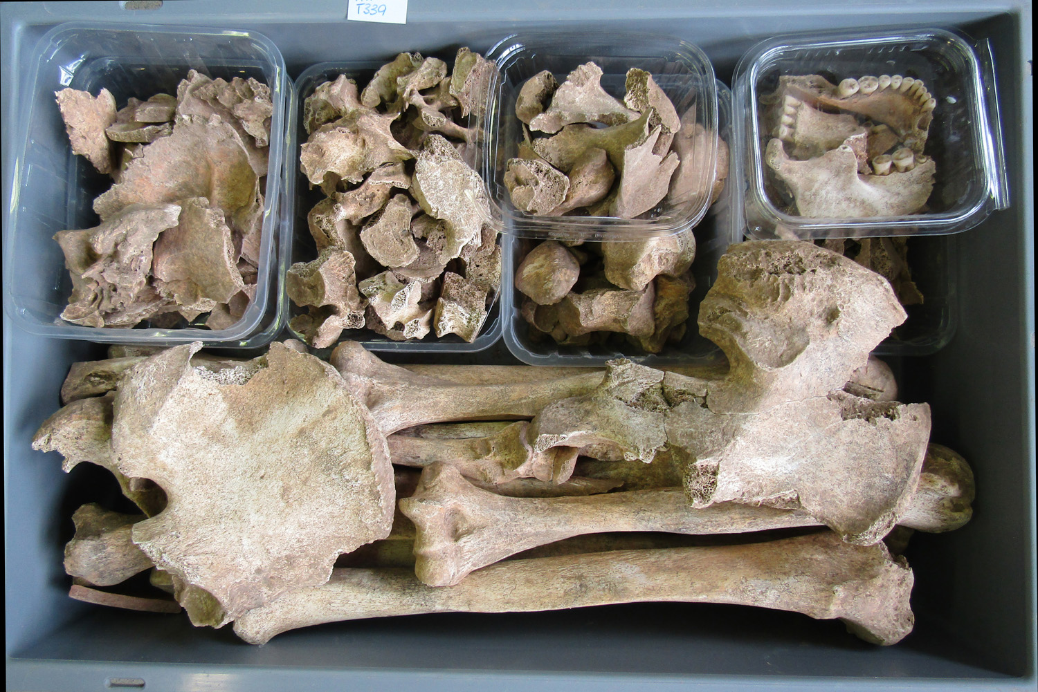 reperti antropologici pertinenti a un unico individuo, reperto osteo-dentario (morfologia naturale, inumato) (PERIODIZZAZIONI/ STORIA/ Età antica/ Età romana/ Età romana imperiale)