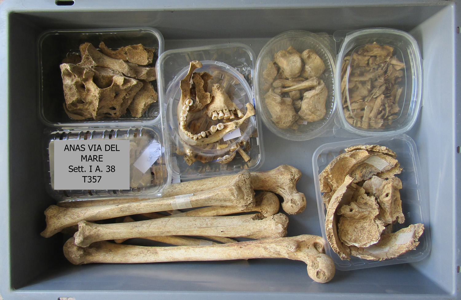 reperti antropologici pertinenti a un unico individuo, reperto osteo-dentario (morfologia naturale, inumato) (PERIODIZZAZIONI/ STORIA/ Età antica/ Età romana/ Età romana imperiale)