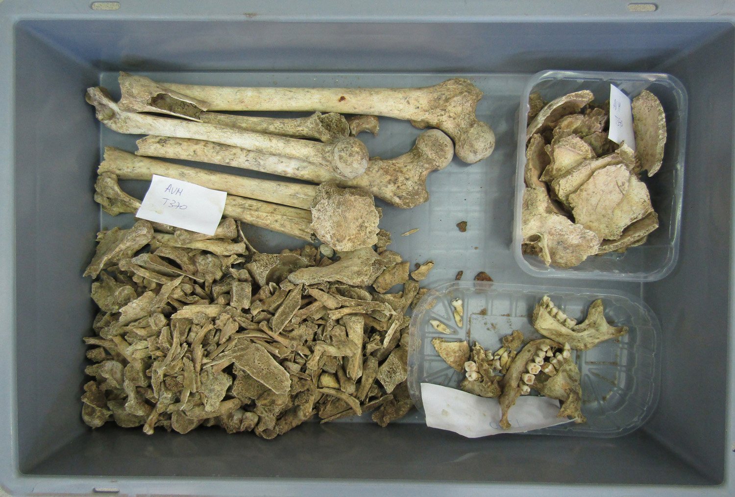 reperti antropologici pertinenti a un unico individuo, reperto osteo-dentario (morfologia naturale, inumato) (PERIODIZZAZIONI/ STORIA/ Età antica/ Età romana/ Età romana imperiale)