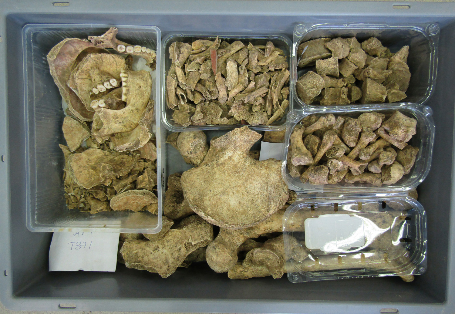 reperti antropologici pertinenti a un unico individuo, reperto osteo-dentario (morfologia naturale, inumato) (PERIODIZZAZIONI/ STORIA/ Età antica/ Età romana/ Età romana imperiale)