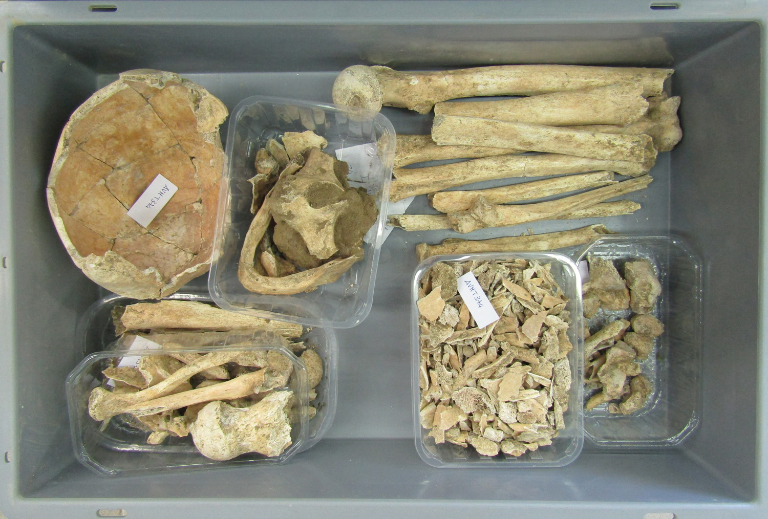 reperti antropologici pertinenti a un unico individuo, reperto osseo (morfologia naturale, inumato) (PERIODIZZAZIONI/ STORIA/ Età antica/ Età romana/ Età romana imperiale)