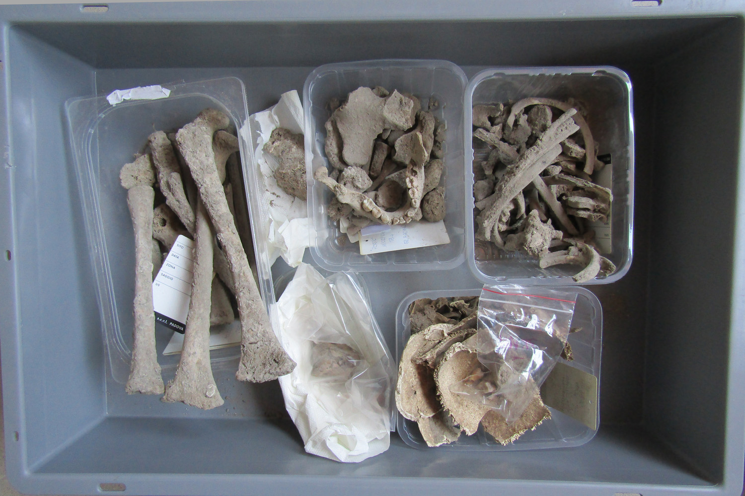 reperti antropologici pertinenti a un unico individuo, reperto osteo-dentario (morfologia naturale, inumato) (PERIODIZZAZIONI/ STORIA/ Età antica/ tardoantico/altomedioevo)