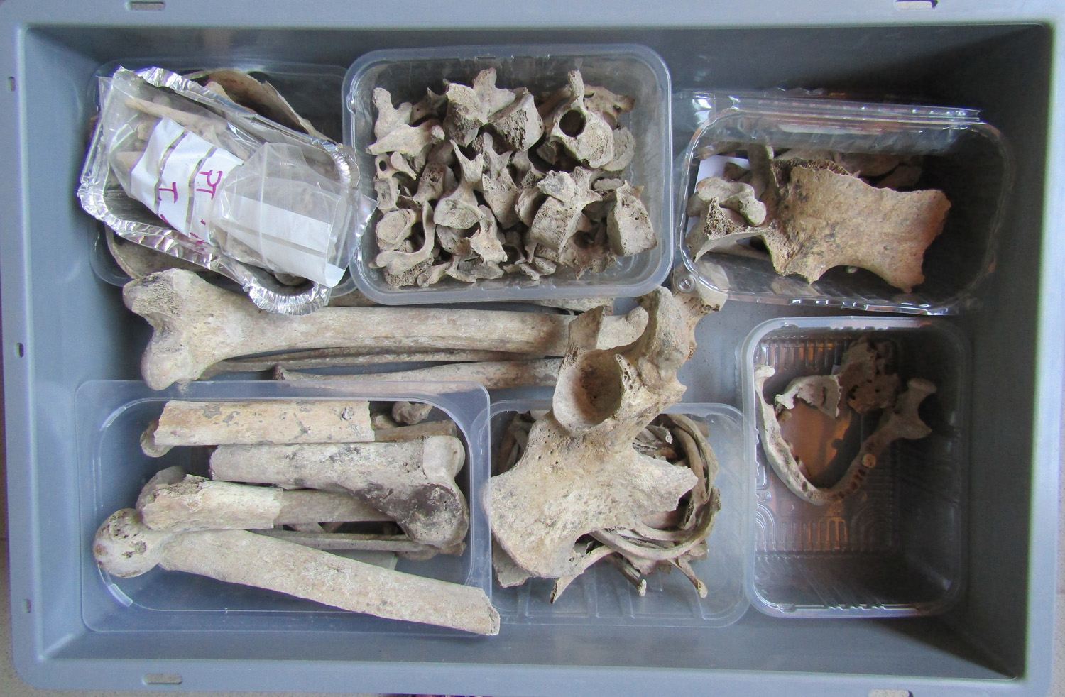 reperti antropologici pertinenti a un unico individuo, reperto osteo-dentario (morfologia naturale, inumato) (PERIODIZZAZIONI/ STORIA/ Età antica/ tardoantico/altomedioevo)