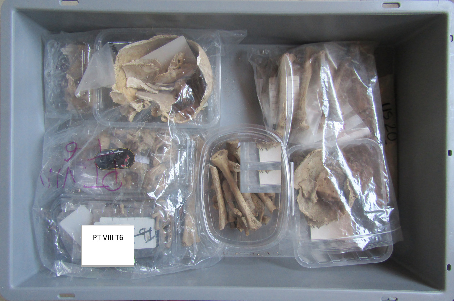 reperti antropologici pertinenti a un unico individuo, reperto osteo-dentario (morfologia naturale, inumato) (PERIODIZZAZIONI/ STORIA/ Età antica/ tardoantico/altomedioevo)