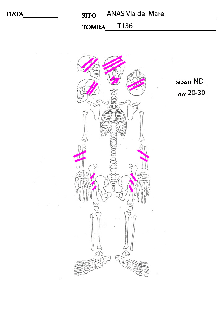 reperti antropologici pertinenti a un unico individuo, reperti ossei (PERIODIZZAZIONI/ STORIA/ Età antica/ Età romana/ Età romana imperiale)