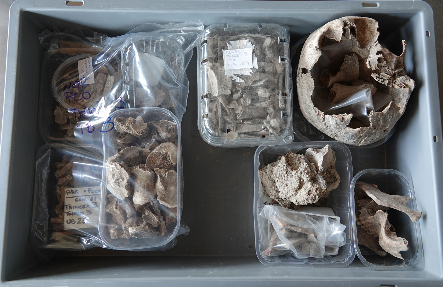 singolo reperto antropologico, reperto osteo-dentario (morfologia naturale, inumato) (PERIODIZZAZIONI/ STORIA/ Età antica/ Età romana/ Età romana imperiale/ Età tardoimperiale)