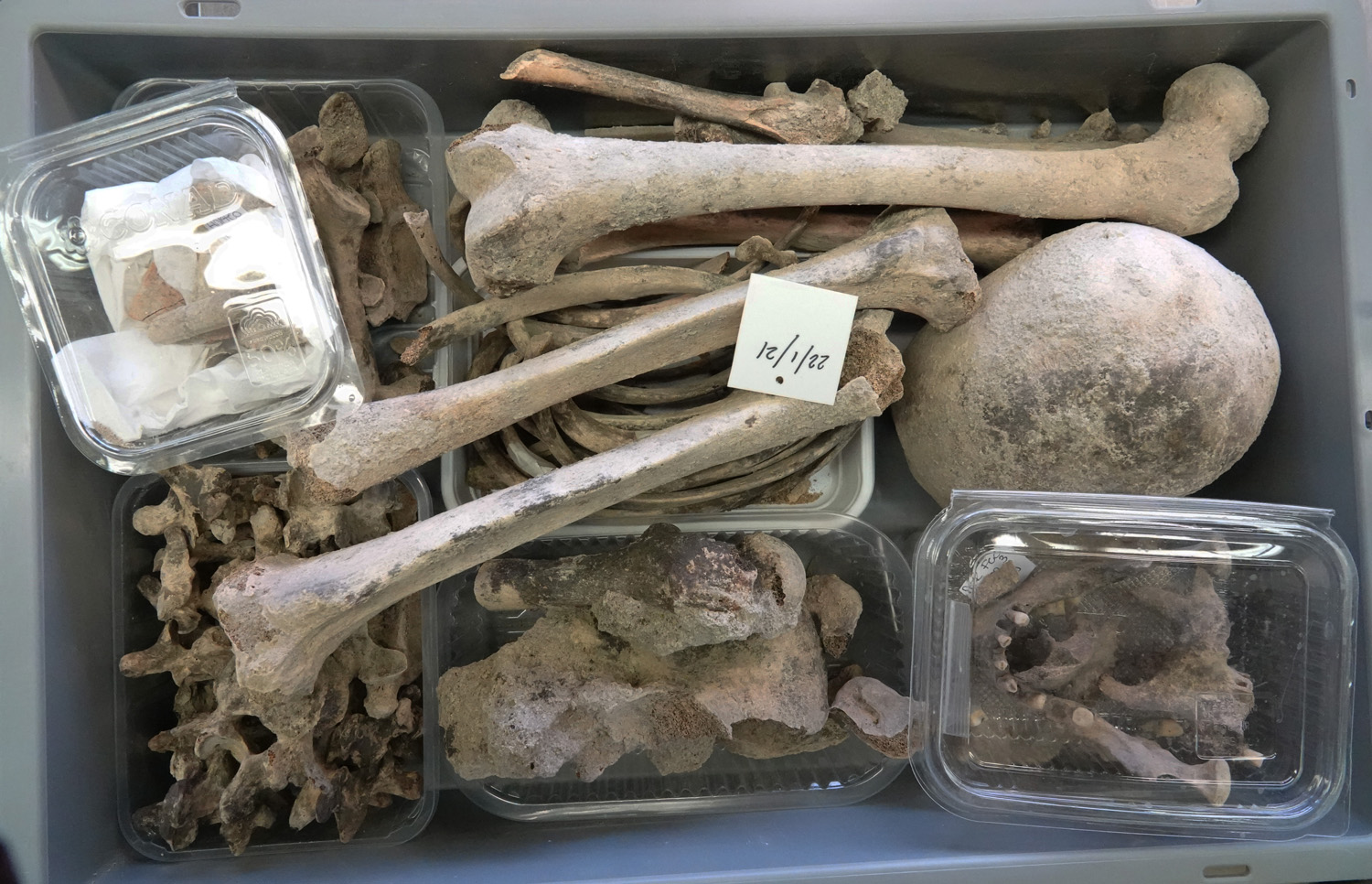 singolo reperto antropologico, reperto osteo-dentario (morfologia naturale, inumato) (PERIODIZZAZIONI/ STORIA/ Età antica/ Età romana/ Età romana imperiale/ Età tardoimperiale)