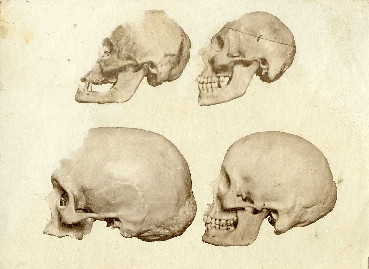 Anatomia umana (positivo) di Anonimo (XIX)